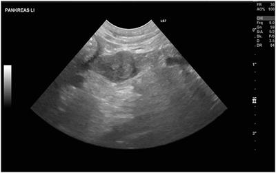Use of indocyanine green near-infrared lymphography to detect sentinel lymph nodes in a dog with a malignant insulinoma: a case report